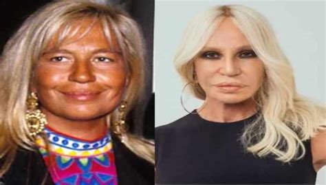 donaatella versace pentita degli interventi chirurgici|Donatella Versace: ricorsa alla chirurgia per sopravvivere.